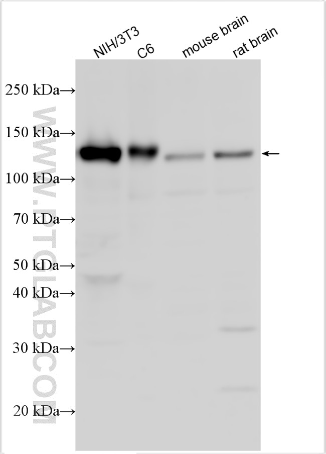 Western Blot (WB) analysis of various lysates using EPHA2 Polyclonal antibody (11652-1-AP)