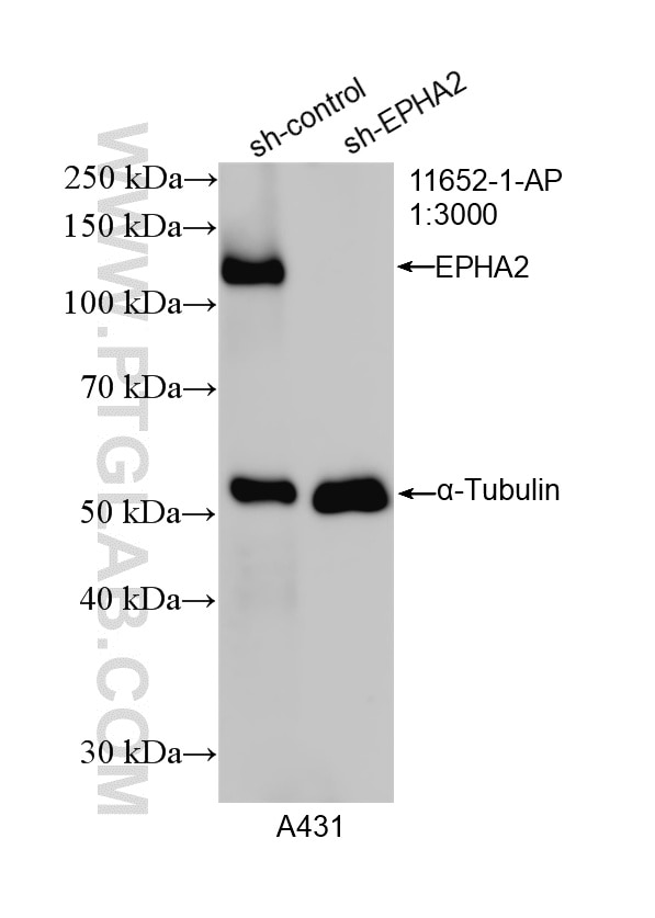 WB analysis of A431 using 11652-1-AP Western Blot (WB) analysis of A431 cells using EPHA2 Polyclonal antibody (11652-1-AP)