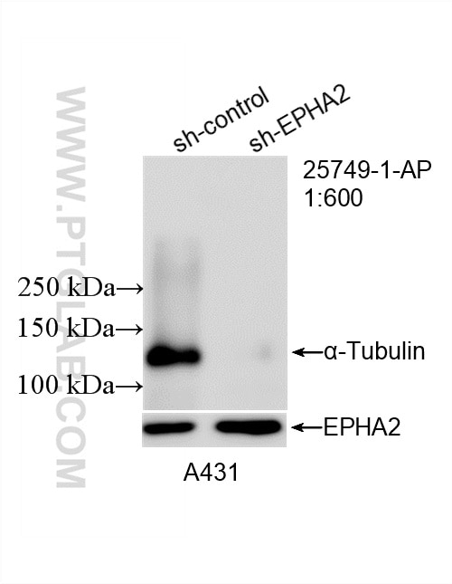 Western Blot (WB) analysis of A431 cells using EPHA2 Polyclonal antibody (25749-1-AP)