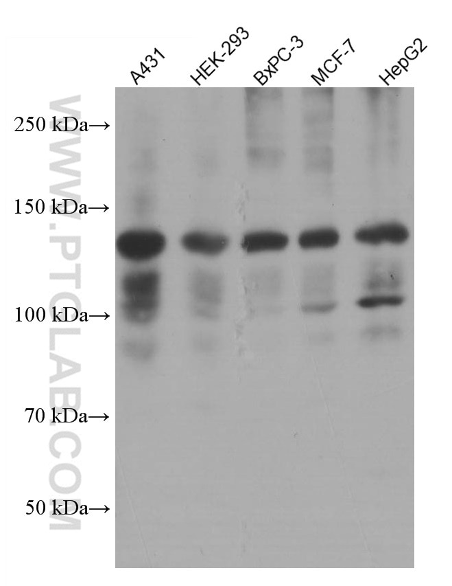 Western Blot (WB) analysis of various lysates using EPHA2 Monoclonal antibody (66736-1-Ig)