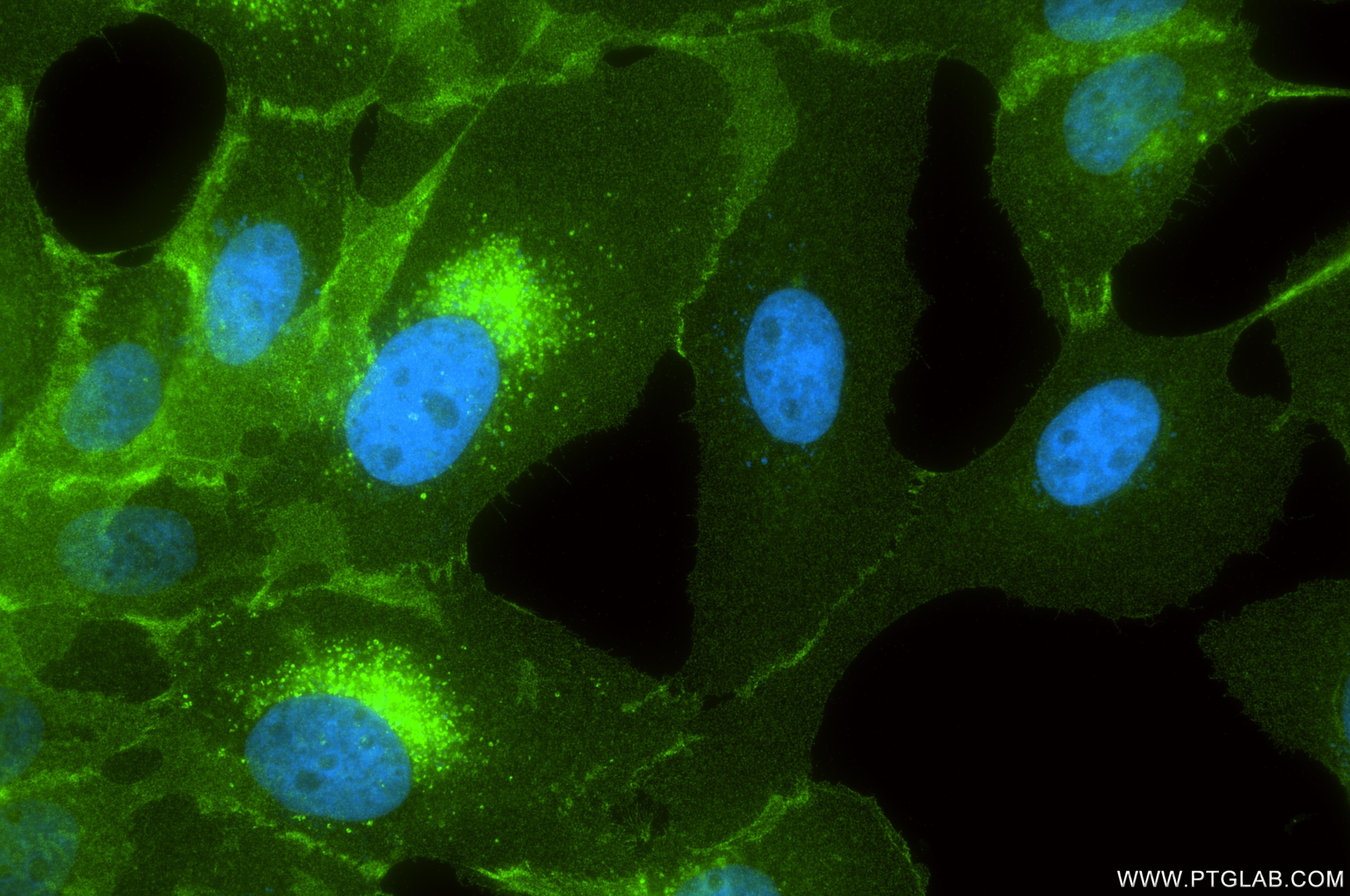 Immunofluorescence (IF) / fluorescent staining of A431 cells using EPHA2 Recombinant monoclonal antibody (87562-1-RR)