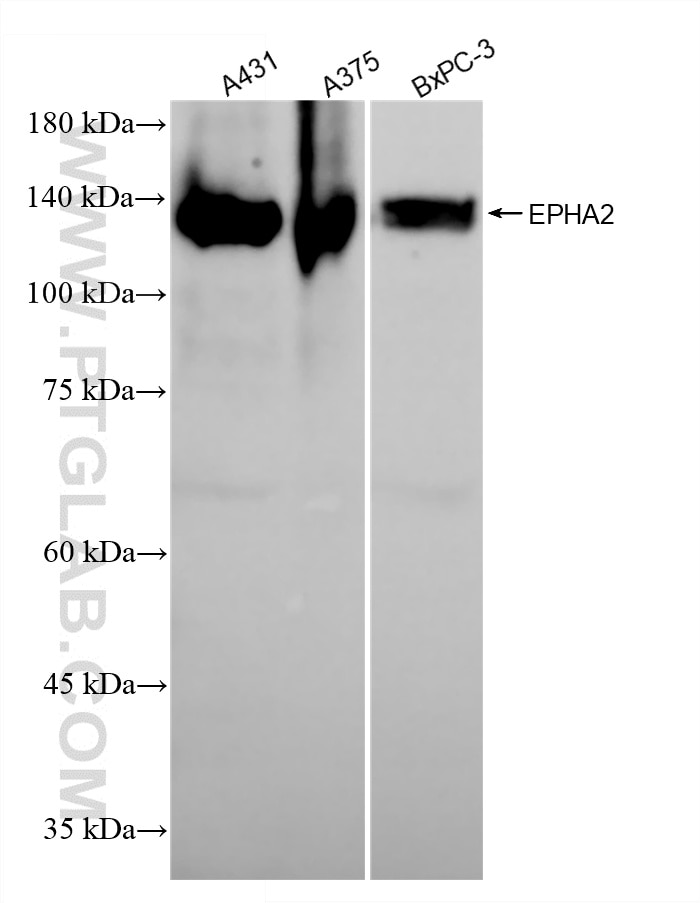 Western Blot (WB) analysis of various lysates using EPHA2 Recombinant monoclonal antibody (87562-1-RR)