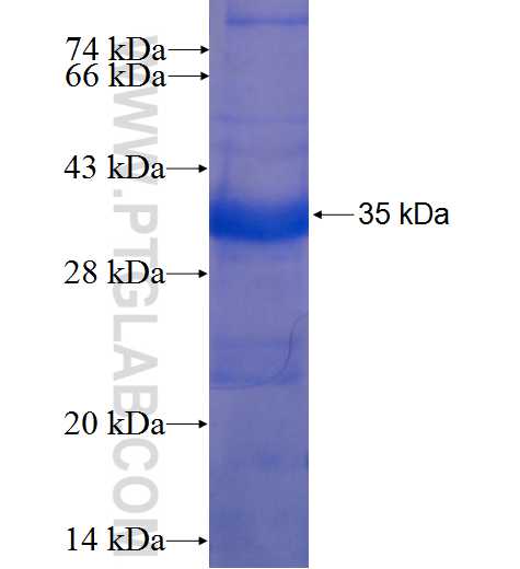 EPHA2 fusion protein Ag22566 SDS-PAGE