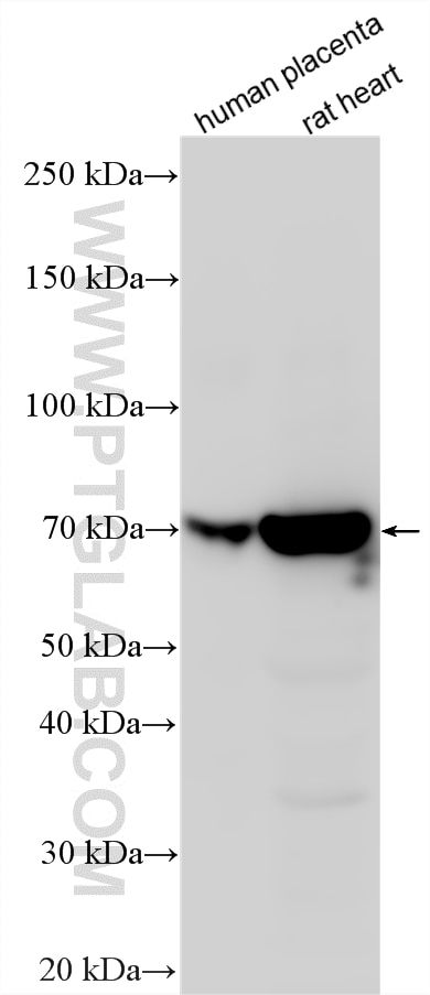 WB analysis using 14097-1-AP Western Blot (WB) analysis of various lysates using EPHA3 Polyclonal antibody (14097-1-AP)