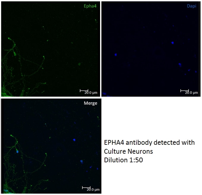 Immunofluorescence (IF) / fluorescent staining of Neuron cells using EphA4 Polyclonal antibody (21875-1-AP)