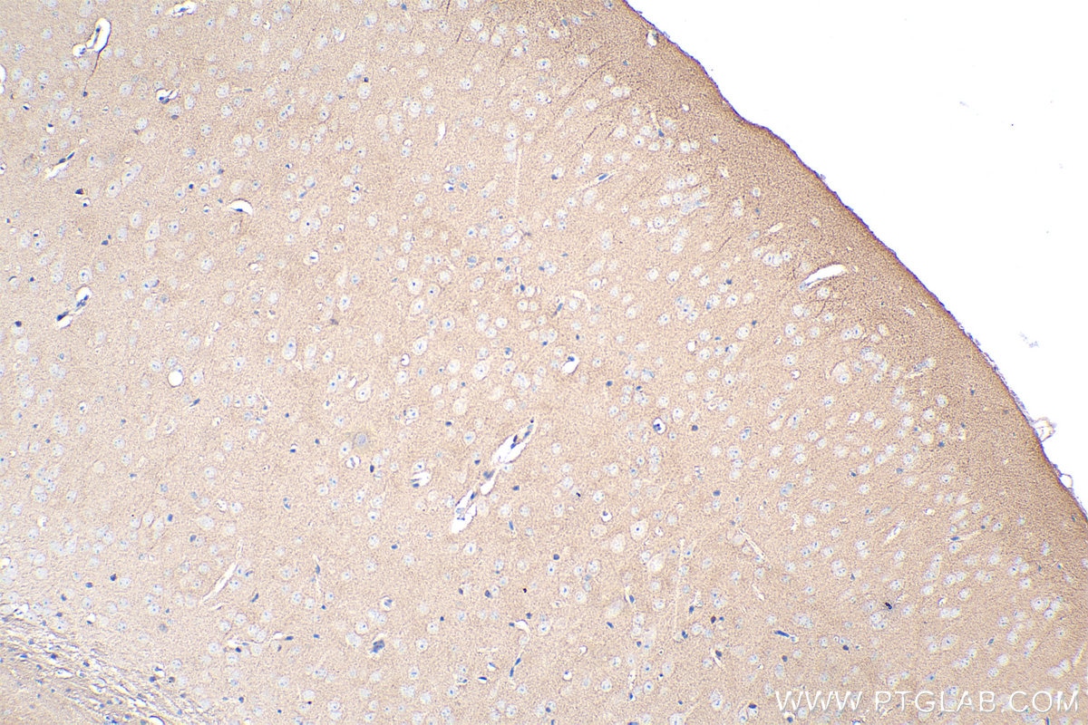 Immunohistochemistry (IHC) staining of mouse brain tissue using EphA4 Polyclonal antibody (21875-1-AP)