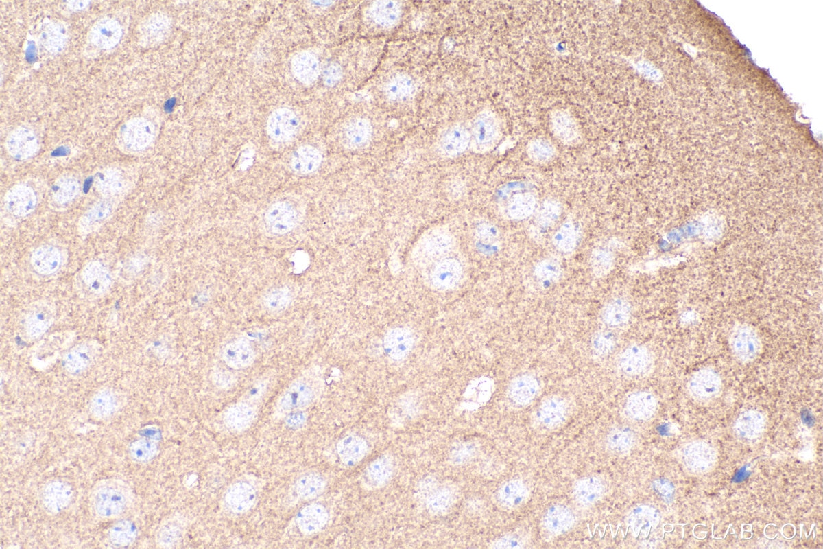 Immunohistochemistry (IHC) staining of mouse brain tissue using EphA4 Polyclonal antibody (21875-1-AP)