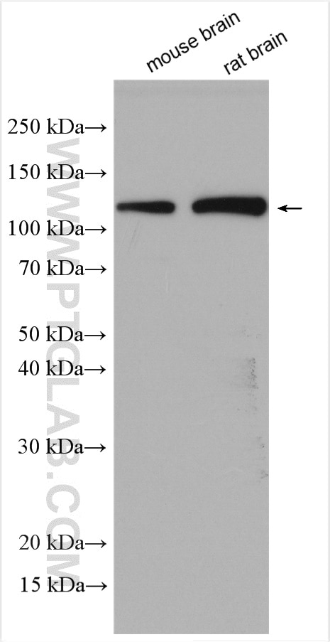 Western Blot (WB) analysis of various lysates using EphA4 Polyclonal antibody (21875-1-AP)