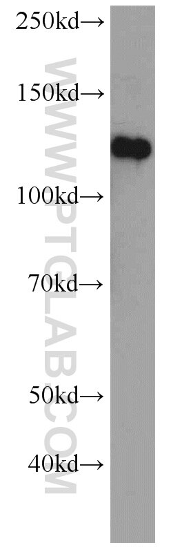 EphA4 Polyclonal antibody