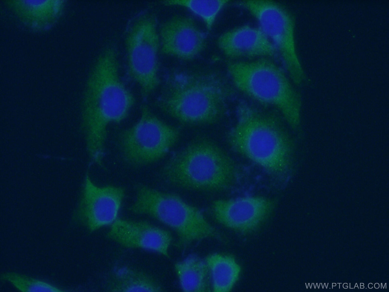 Immunofluorescence (IF) / fluorescent staining of SH-SY5Y cells using EPHA5 Polyclonal antibody (55215-1-AP)