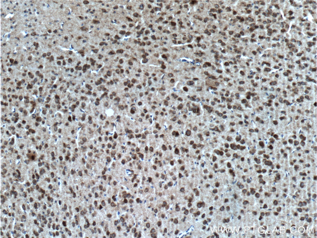 Immunohistochemistry (IHC) staining of mouse brain tissue using EPHA5 Polyclonal antibody (55215-1-AP)