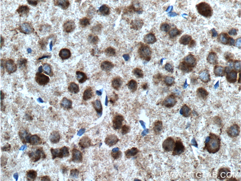 Immunohistochemistry (IHC) staining of mouse brain tissue using EPHA5 Polyclonal antibody (55215-1-AP)