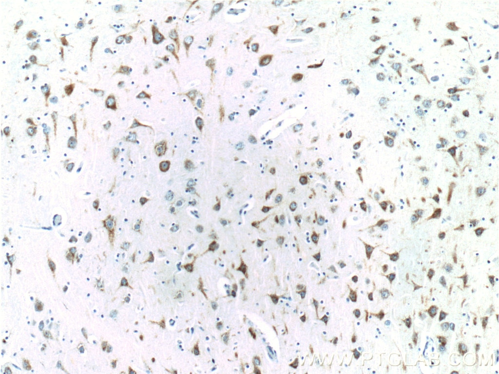 Immunohistochemistry (IHC) staining of human brain tissue using EPHA6 Polyclonal antibody (24452-1-AP)
