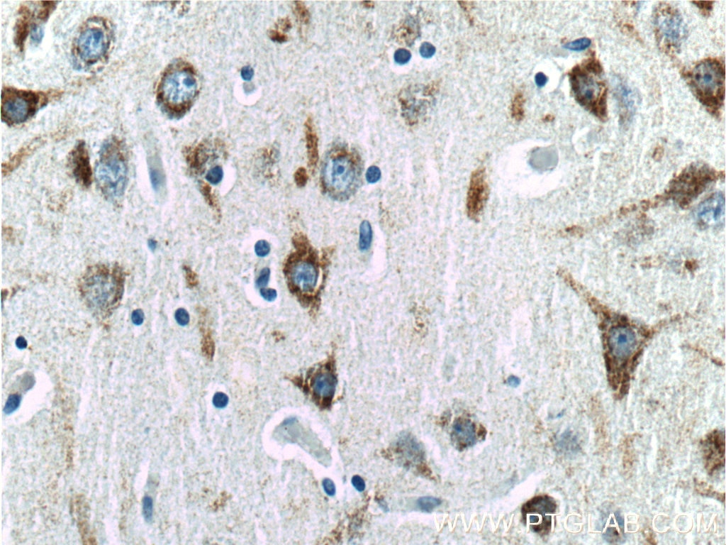 Immunohistochemistry (IHC) staining of human brain tissue using EPHA6 Polyclonal antibody (24452-1-AP)