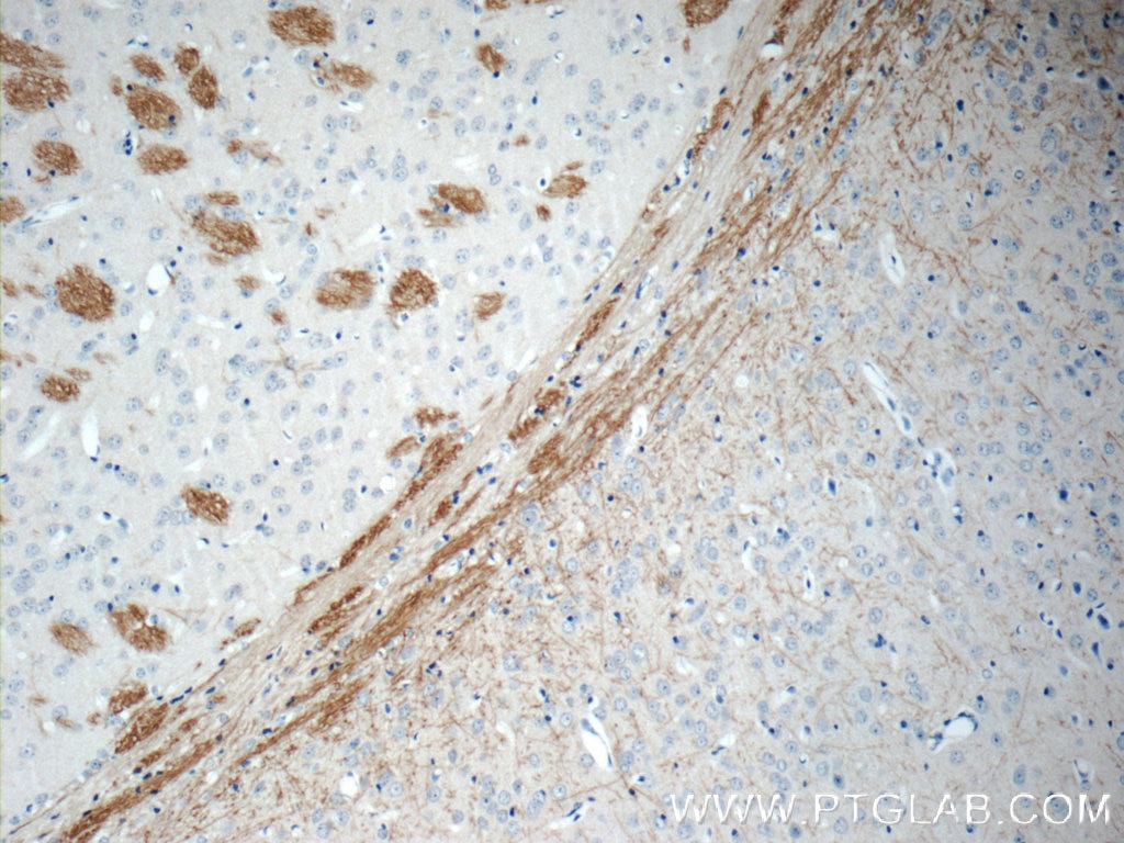 Immunohistochemistry (IHC) staining of mouse brain tissue using EPHA6-Specific Polyclonal antibody (20211-1-AP)