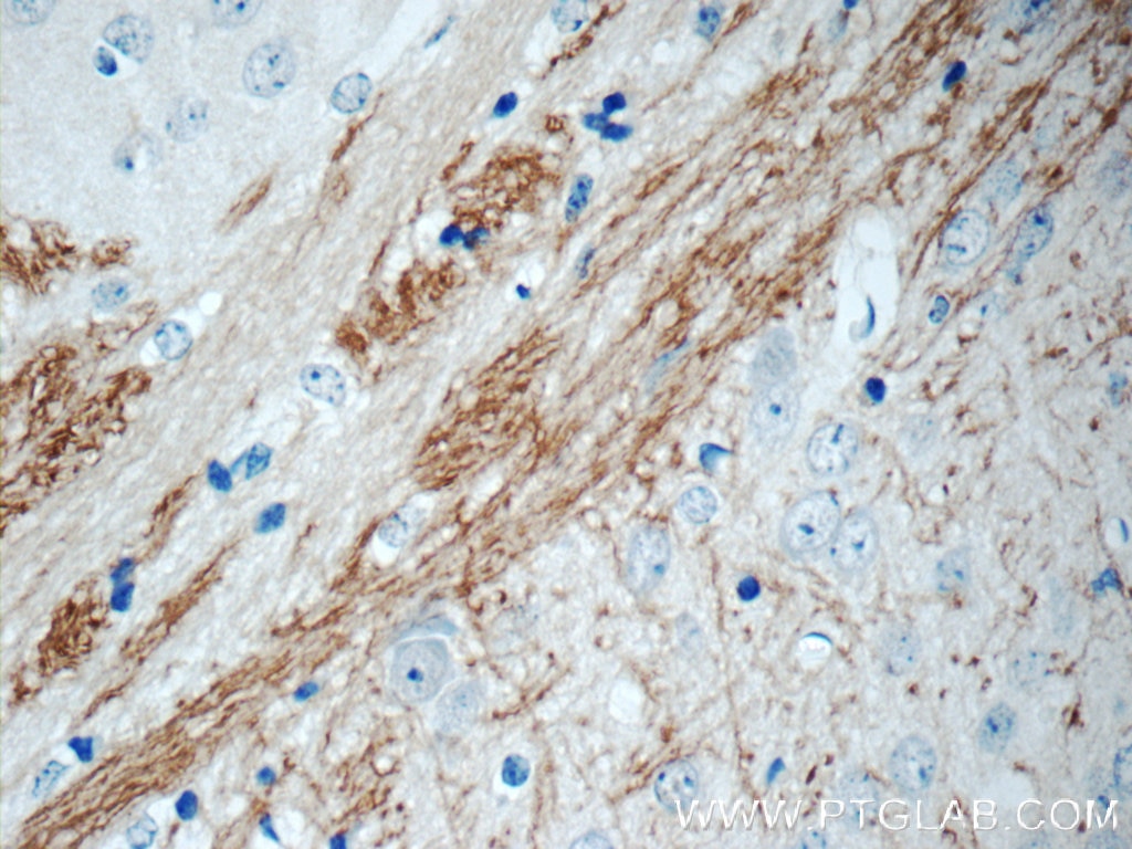 Immunohistochemistry (IHC) staining of mouse brain tissue using EPHA6-Specific Polyclonal antibody (20211-1-AP)