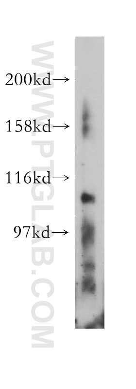 Western Blot (WB) analysis of mouse heart tissue using EPHA7 Polyclonal antibody (13119-1-AP)