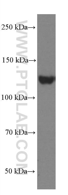 Western Blot (WB) analysis of human brain tissue using EPHA7 Monoclonal antibody (66667-1-Ig)