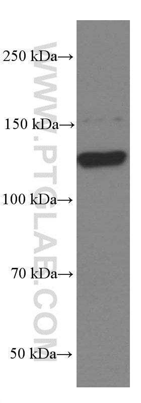 Western Blot (WB) analysis of pig brain tissue using EPHA7 Monoclonal antibody (66667-1-Ig)