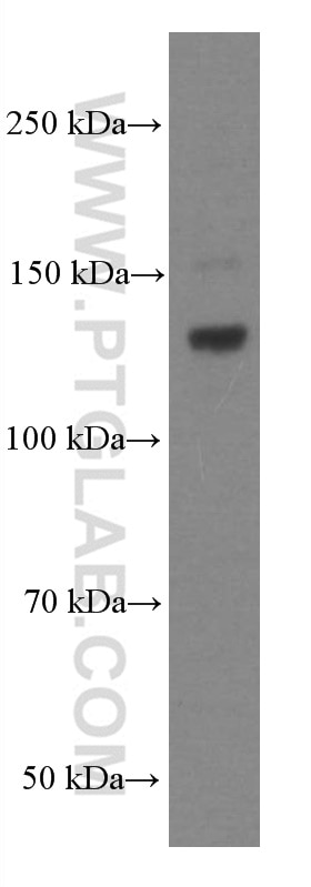 Western Blot (WB) analysis of rat brain tissue using EPHA7 Monoclonal antibody (66667-1-Ig)