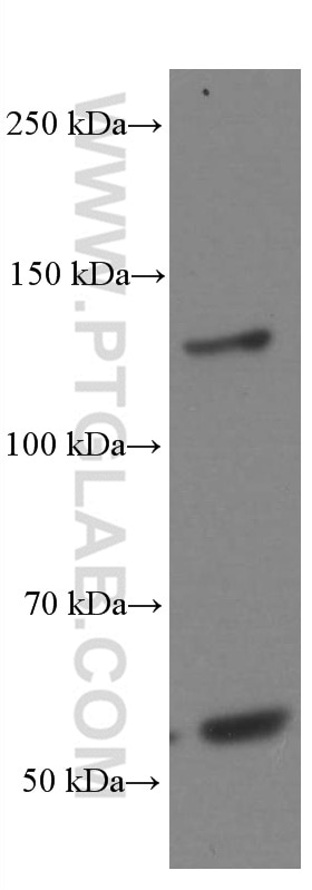 Western Blot (WB) analysis of mouse cerebellum tissue using EPHA7 Monoclonal antibody (66667-1-Ig)