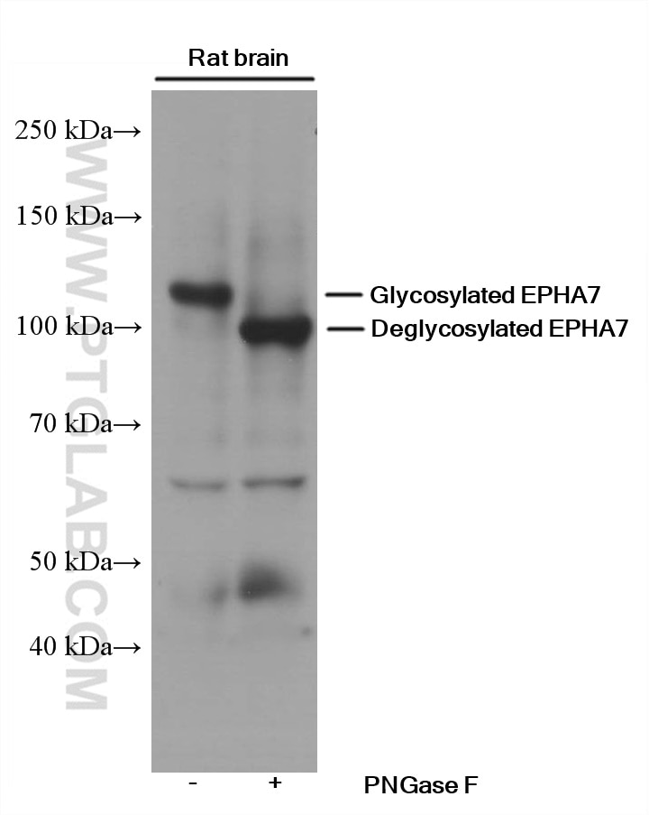 Western Blot (WB) analysis of rat brain tissue using EPHA7 Monoclonal antibody (66667-1-Ig)