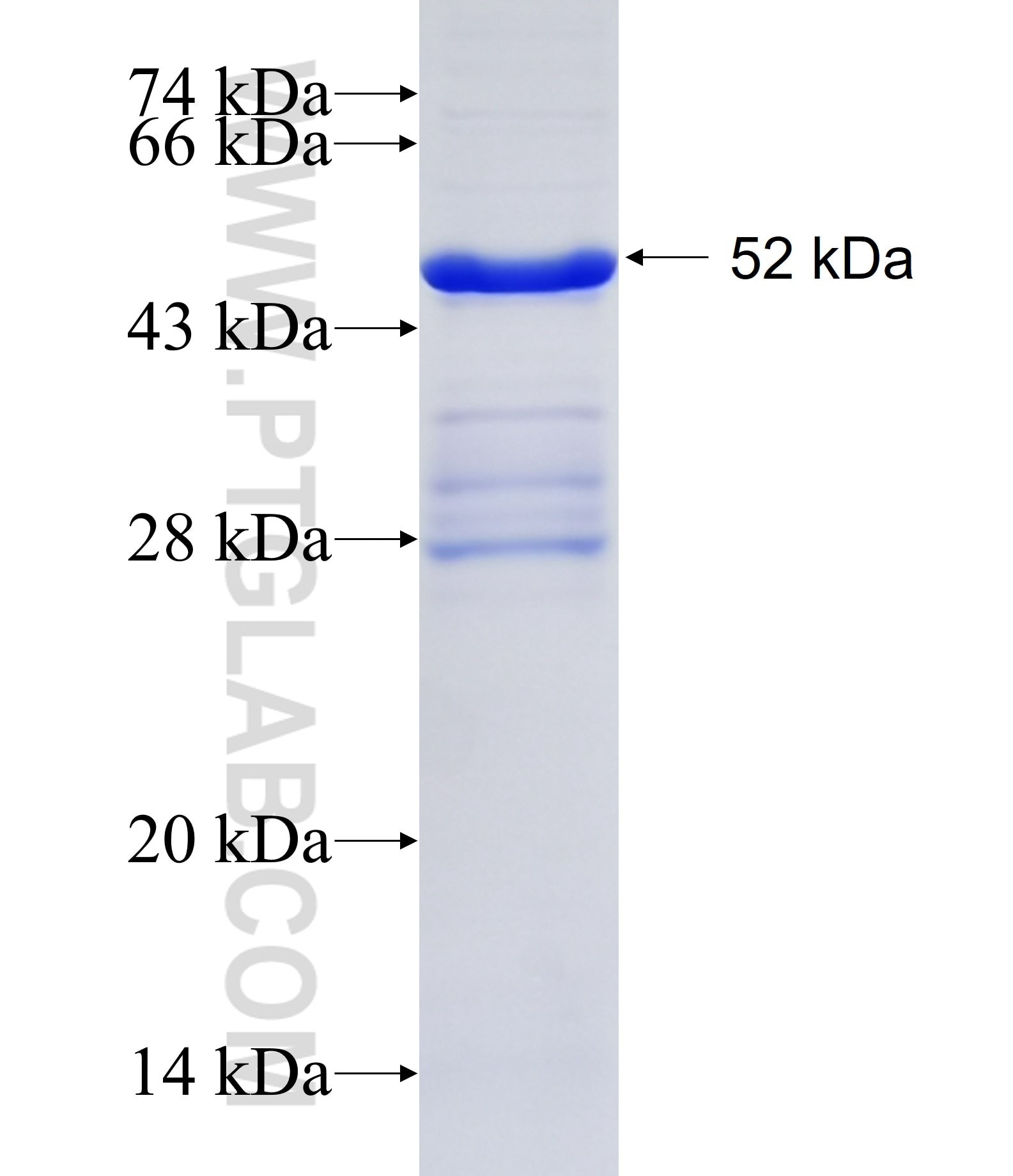 EPHA7 fusion protein Ag27387 SDS-PAGE