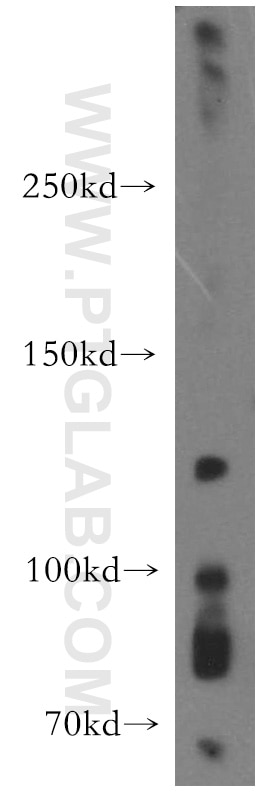 Western Blot (WB) analysis of mouse brain tissue using EPHA8 Polyclonal antibody (13724-1-AP)