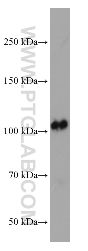 Western Blot (WB) analysis of fetal human brain tissue using EPHB1 Monoclonal antibody (67080-1-Ig)