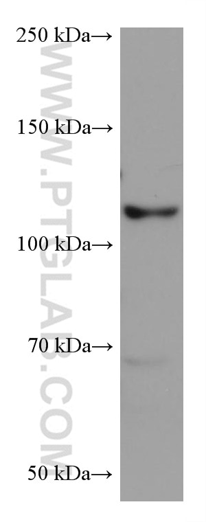 Western Blot (WB) analysis of mouse brain tissue using EPHB1 Monoclonal antibody (67080-1-Ig)