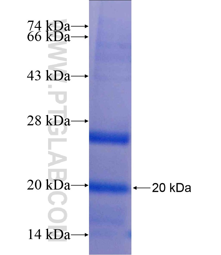 EPHB1 fusion protein Ag18075 SDS-PAGE