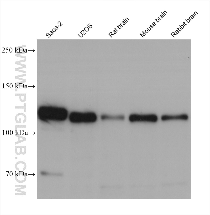 WB analysis using 60908-3-Ig (same clone as 60908-3-PBS) Western Blot (WB) analysis of various lysates using EPHB2 Monoclonal antibody (60908-3-Ig)