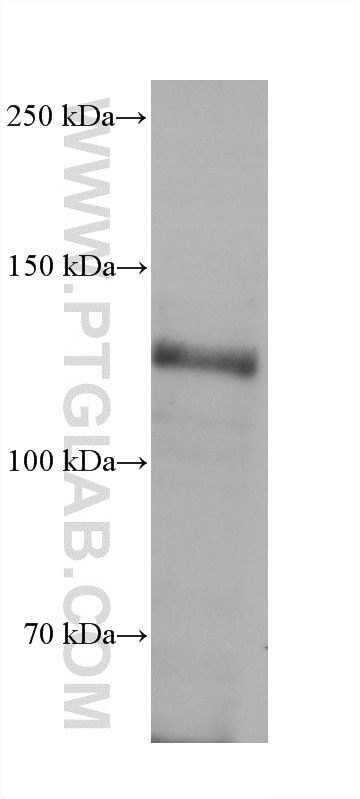 WB analysis of HeLa using 60908-3-Ig (same clone as 60908-3-PBS) Western Blot (WB) analysis of HeLa cells using EPHB2 Monoclonal antibody (60908-3-Ig)