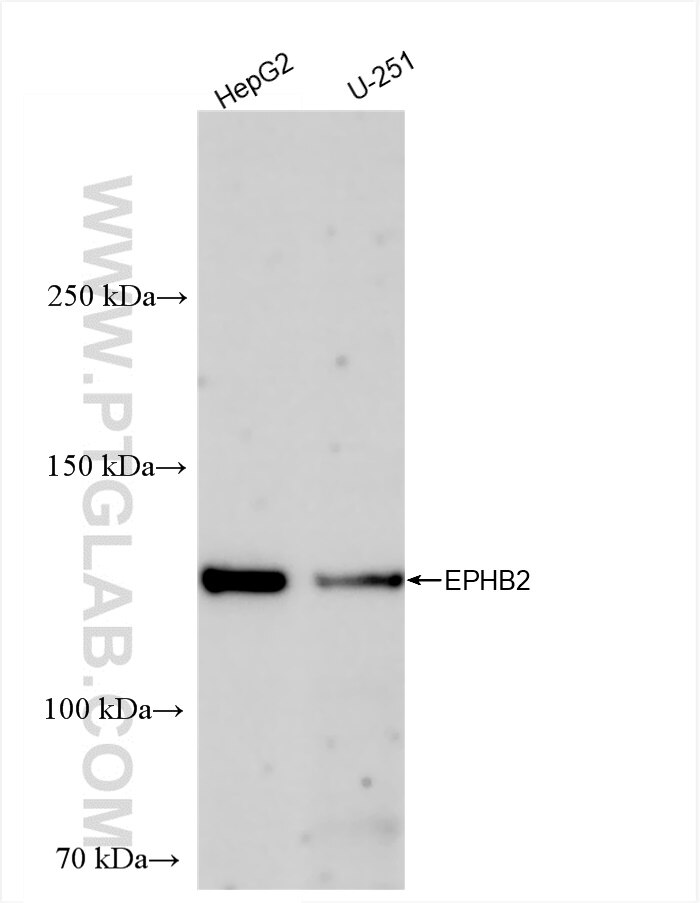 Western Blot (WB) analysis of various lysates using EPHB2 Recombinant antibody (83277-1-RR)