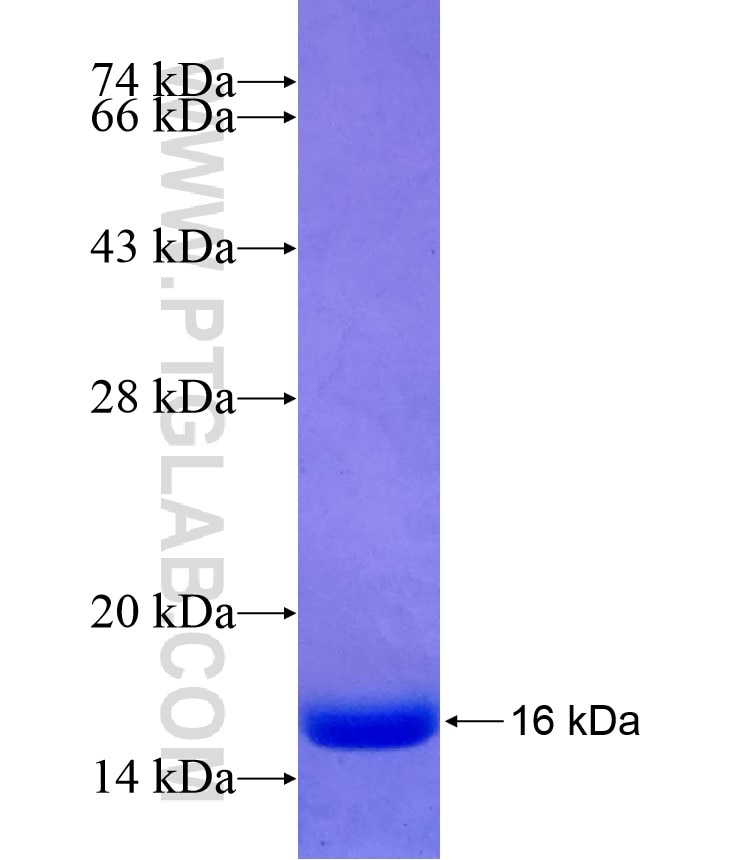 EPHB2 fusion protein Ag28796 SDS-PAGE