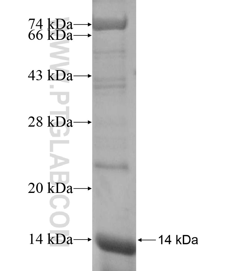 EPHB2 fusion protein Ag17005 SDS-PAGE