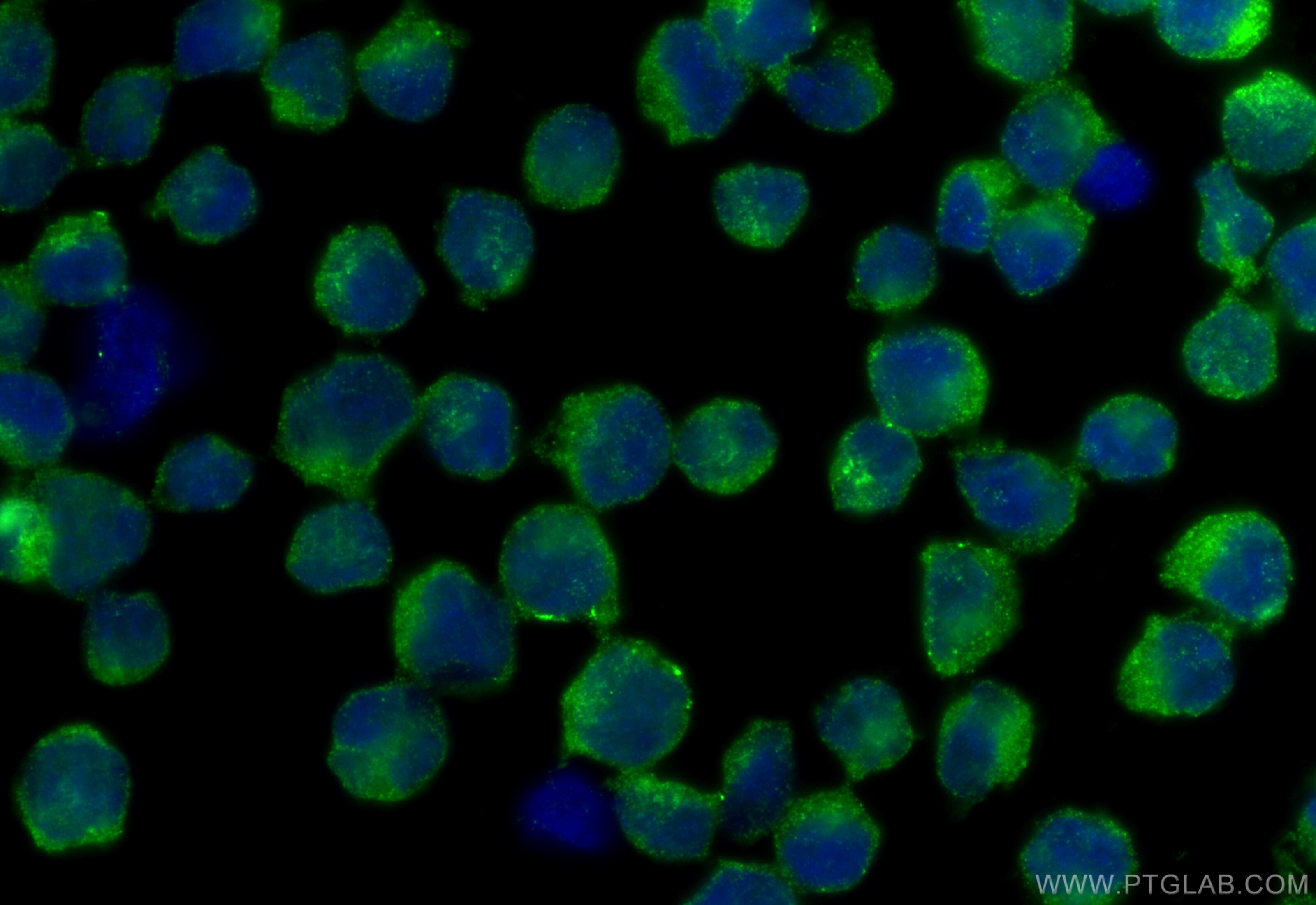 Immunofluorescence (IF) / fluorescent staining of Jurkat cells using EPHB3 Polyclonal antibody (21382-1-AP)