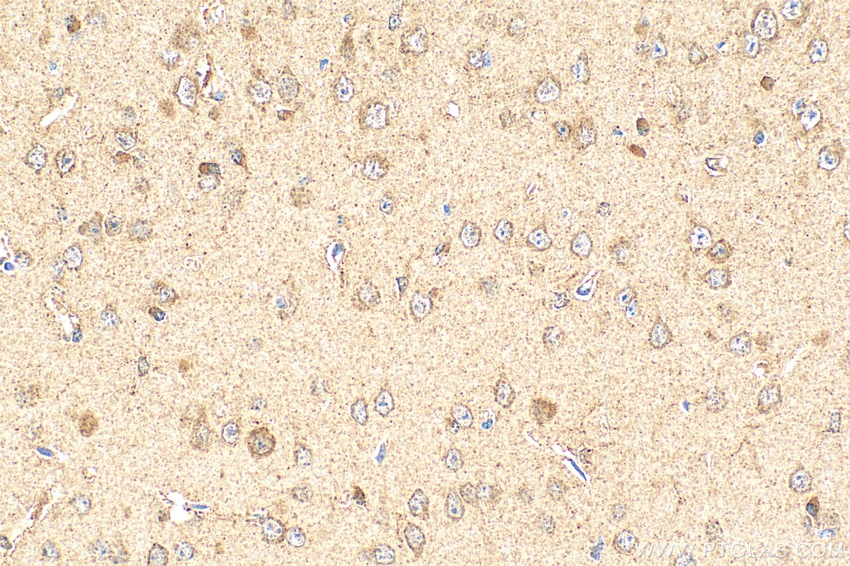 Immunohistochemistry (IHC) staining of mouse brain tissue using EPHB3 Polyclonal antibody (21382-1-AP)