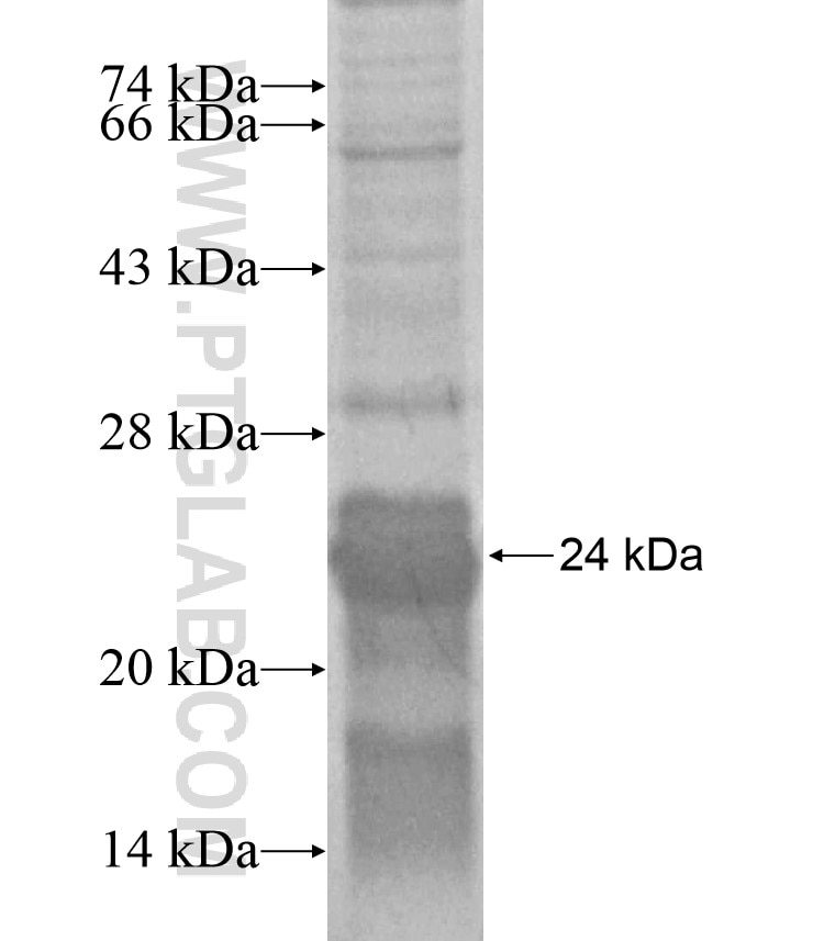 EPHB3 fusion protein Ag17050 SDS-PAGE