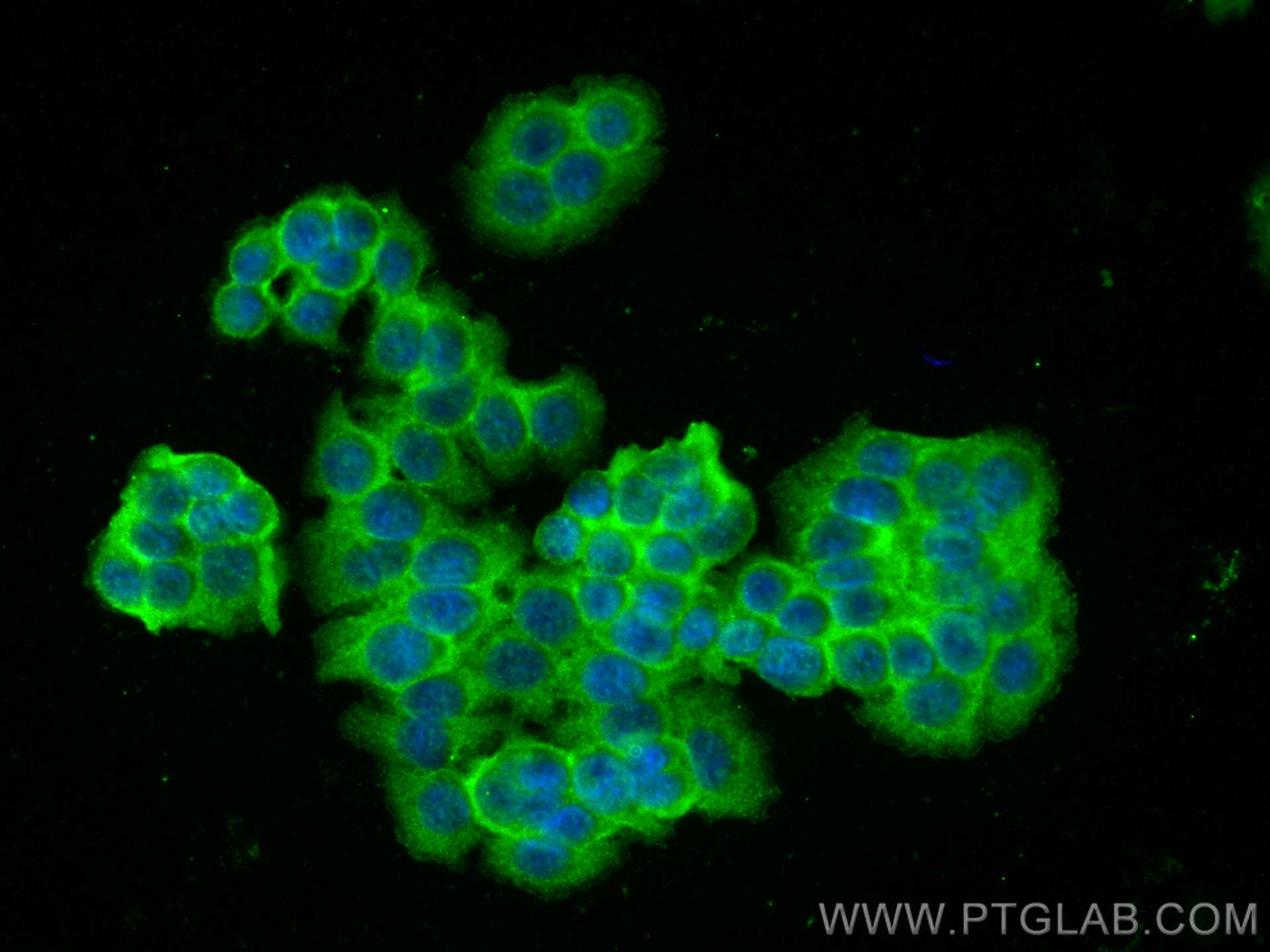 Immunofluorescence (IF) / fluorescent staining of HT-29 cells using EPHB4 Polyclonal antibody (20883-1-AP)