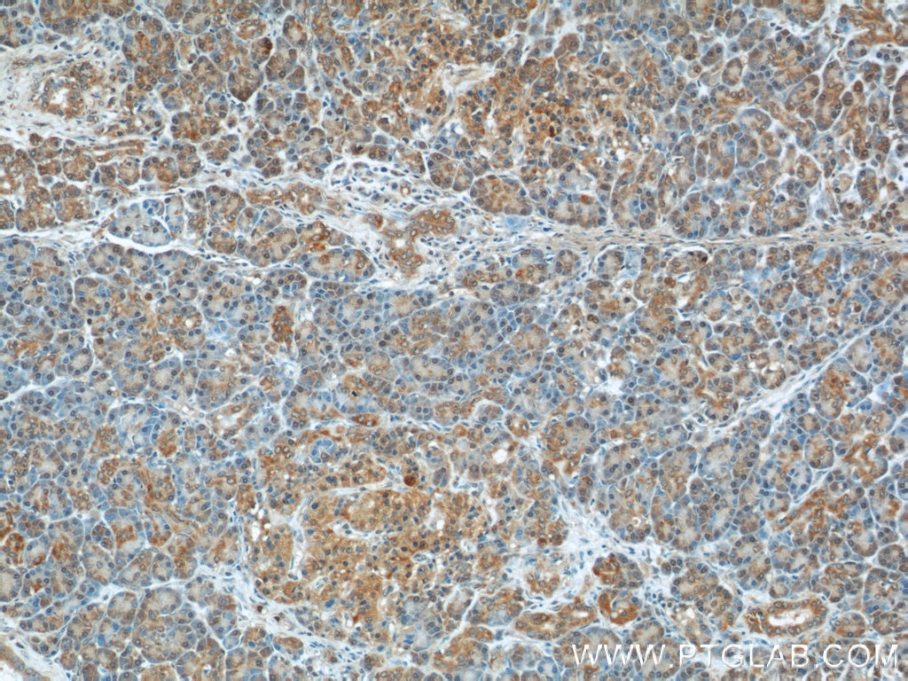 Immunohistochemistry (IHC) staining of human pancreas tissue using EPHB4 Polyclonal antibody (20883-1-AP)