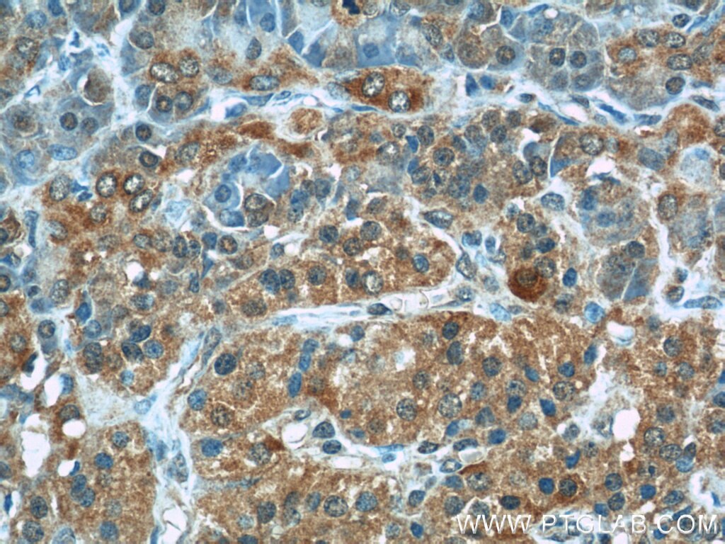 Immunohistochemistry (IHC) staining of human pancreas tissue using EPHB4 Polyclonal antibody (20883-1-AP)