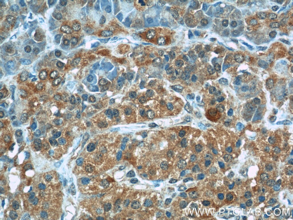 IHC staining of human pancreas using 20883-1-AP