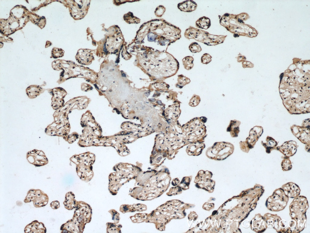 Immunohistochemistry (IHC) staining of human placenta tissue using EPHB4 Polyclonal antibody (20883-1-AP)