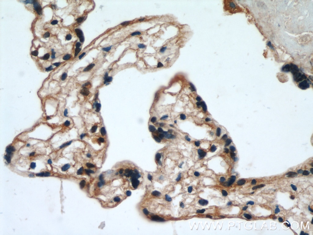 Immunohistochemistry (IHC) staining of human placenta tissue using EPHB4 Polyclonal antibody (20883-1-AP)