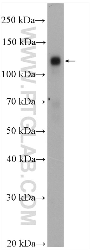 Western Blot (WB) analysis of rat testis tissue using EPHB4 Polyclonal antibody (20883-1-AP)
