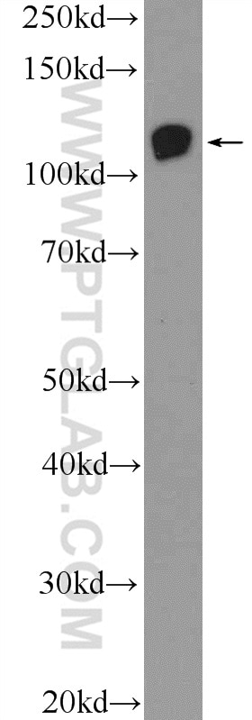 Western Blot (WB) analysis of rat testis tissue using EPHB4 Polyclonal antibody (20883-1-AP)