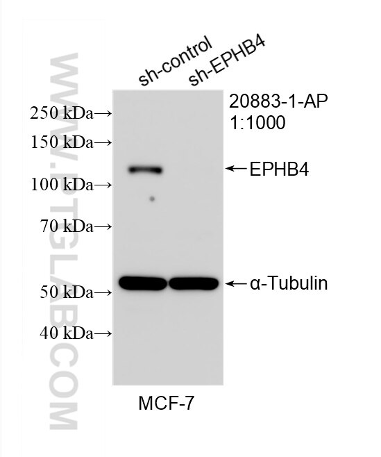 Western Blot (WB) analysis of MCF-7 cells using EPHB4 Polyclonal antibody (20883-1-AP)