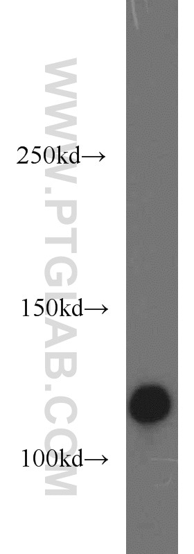 Western Blot (WB) analysis of HeLa cells using EPHB4 Polyclonal antibody (20883-1-AP)