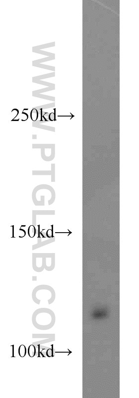 WB analysis of HT-1080 using 20883-1-AP